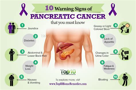 If there is a strong history of pancreatic cancer in jaundice (yellow color) in the skin or eyes. 10 Warning Signs of Pancreatic Cancer that You Must Know ...