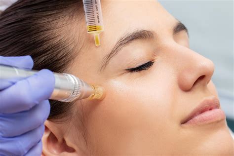 Beauty Lodge Stem Cell Micro Needling Facial Health And Beauty Clinic