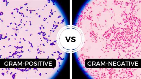 Difference Between Gram Positive And Gram Negative Bacteria Online