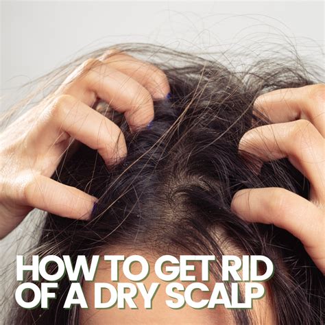 What Causes Dry Scalp Sobo Hair Boutique