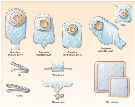 Types Of Colostomy Bags After Surgery Iucn Water