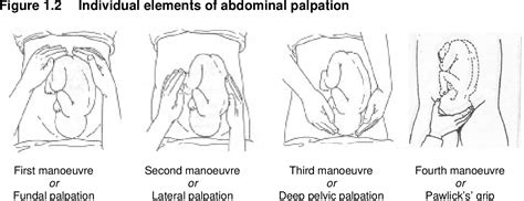 Abdominal Palpation To Determine Fetal Position At The Onset Of Labour