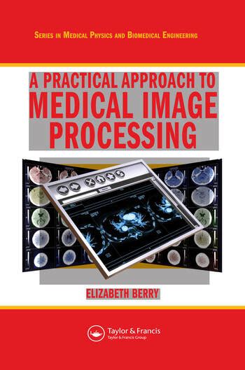 A Practical Approach To Medical Image Processing Crc Press Book