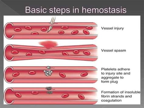 Basic Steps In Hemostasis Nurse Info