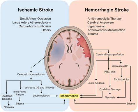 Hemorrhagic Stroke Pathophysiology