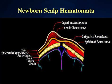 Ppt Newborn Examination Powerpoint Presentation Free Download Id