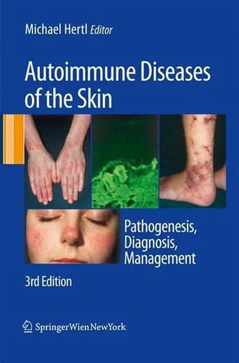 Autoimmune Diseases Of The Skin Pathogenesis Diagnosis Management