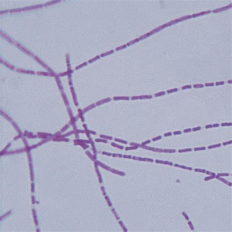 Bacillus Anthracis Wm Microscope Slide Microscope Sample Slides