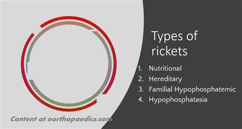 4 Different Types Of Rickets To Know In Orthopaedics Oorthopaedics