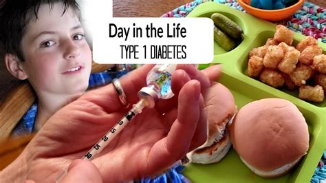 Day In The Life Type 1 Diabetes Youtube