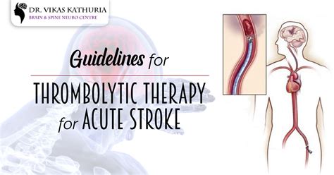 Best Thrombolytic Therapy For Acute Stroke