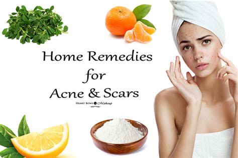 Albuquerque Facial Laser Resurfacing Severe Forehead Acne Treatment What Home Remedies For