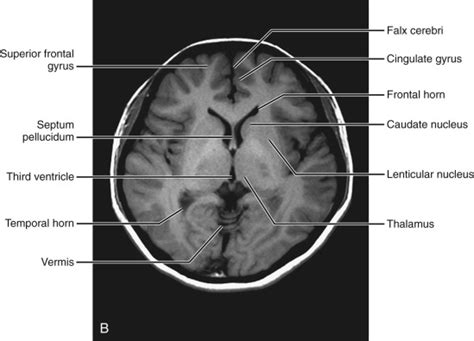 Normal Anatomy Radiology Key