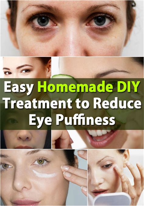 Easy Homemade Diy Treatment To Reduce Eye Puffiness Diy And Crafts
