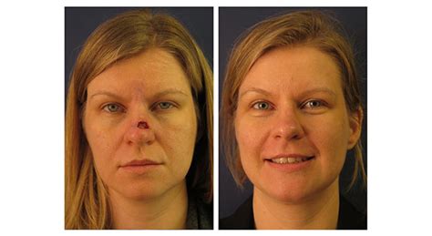 Face Reconstruction