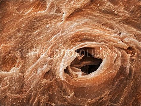 Coloured Scanning Electron Micrograph Sem Of A Sweat Pore On A Human