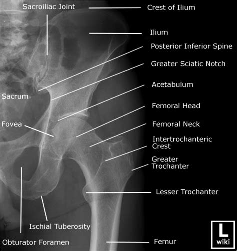 Pelvic Anatomy Xray Female Pelvis Bones And Joints X Ray Stock