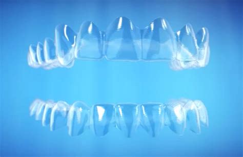 Invis Cover Invisalign In Miami Fl