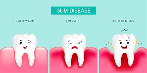 Gum Treatments In Maitland Rutherford Dental