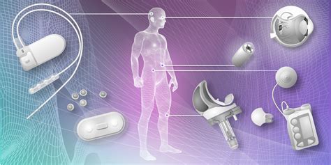 Smart Implants For Surgery Ieee Life Sciences