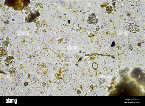 Microscopic Microorganisms Under The Microscope Stock Photo Alamy