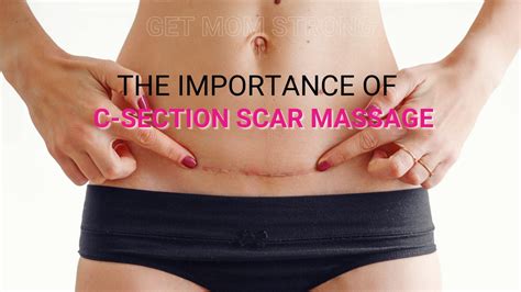 C Section Scar Massage How And Why Get Mom Strong