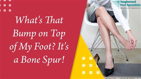 Bone Spur Ganglion Cyst Podiatrist In Houston Tanglewood Foot Specialists
