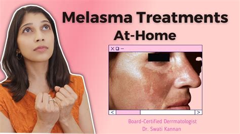 How To Get Rid Of Melasma Or Facial Skin Discoloration At Home