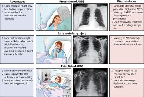 Clinical Trials In Acute Respiratory Distress Syndrome Challenges And