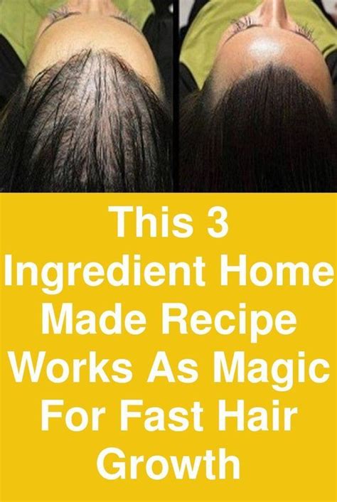 This 3 Ingredient Home Made Recipe Works As Magic For Fast Hair Growth