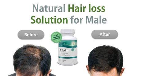Hair Loss Solutions