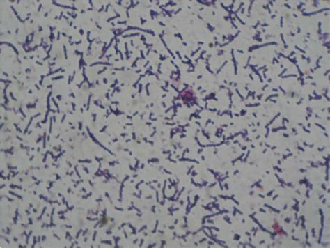 Gram’s Stain Of The Streptococcus Spp Showing Gram Positive Cocci In Download Scientific