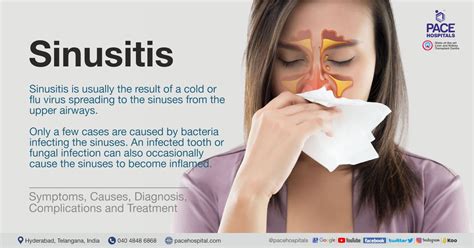 Sinusitis Types Causes Symptoms Complications And Treatment