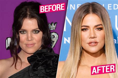 Proof Khloe Kardashian Plastic Surgery Has Gone Too Far