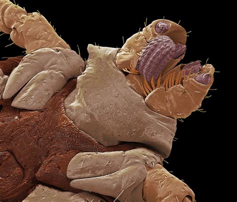 American Dog Tick Mouth Parts Photograph By Steve Gschmeissnerscience