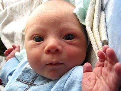 It's not at all exact, and your baby could be very different. Down Syndrome: A Day to Day Guide: Prenatal