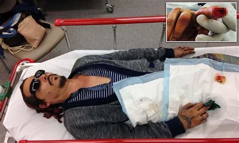 Johnny Depp Shares Photo Of Finger Severed By Vodka Bottle Daily Mail