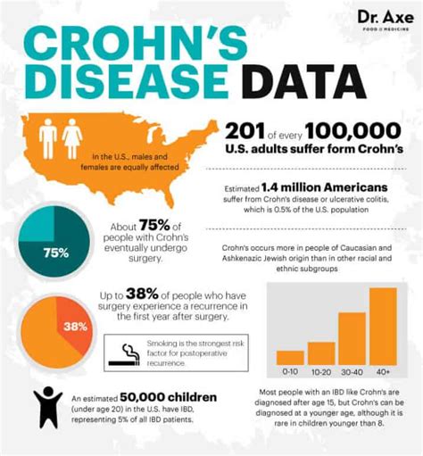 Crohns Disease Symptoms Facts And Risk Factors Dr Axe