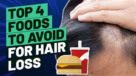 Foods That Cause Hair Loss Top 4 Foods To Avoid Youtube
