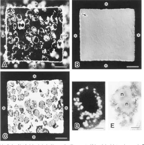 Figure 1 From Correlative Microscopy Using Fluoronanogold On Ultrathin