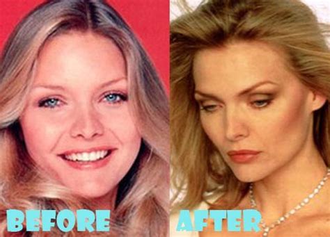 Michelle Pfeiffer Plastic Surgery Well We Are Going To Talk About Her