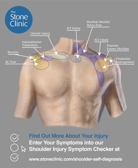 Shoulder Pain Symptom Checker Pain Diagnosis Chart Injury Self