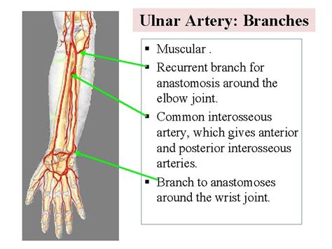 Vascular Anatomy Of The Upper Limb Department Of
