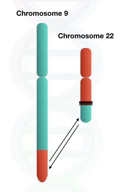 Philadelphia Chromosome Reciprocal Translocation Between Chromosome 9