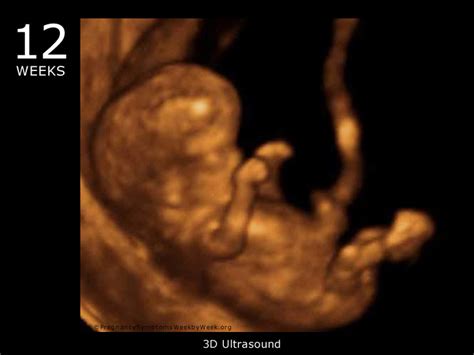 12 Week 3d Ultrasound Baby Picture Pregnancy Symptoms Week By Week