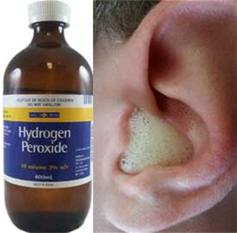 How to treat ear infections with hydrogen peroxide. 9 Home Remedies to Get Rid of Earache in Adults & Children
