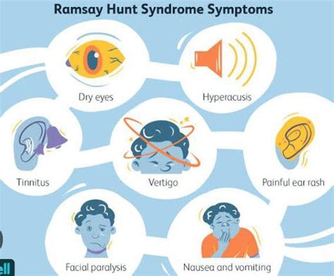 Symptoms Of Ramsay Hunt Syndrome Medizzy