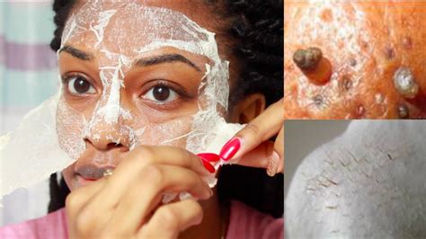 At these marvelous discounts, get the best. EASY DIY Egg Blackhead Remover Peel Off Mask - YouTube