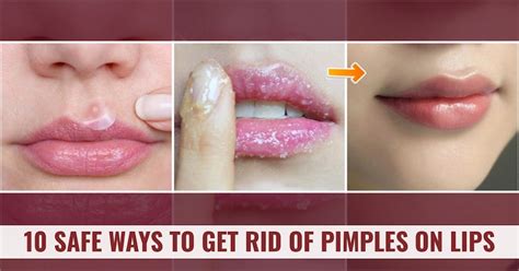 How To Cover A Lip Pimple With Makeup