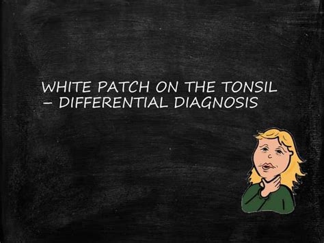 White Patch On The Tonsil Differential Diagnosis Ppt
